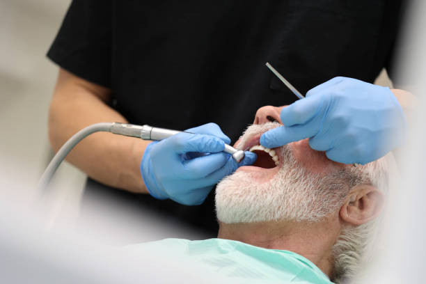 Oral Cancer Screening in Loomis, CA